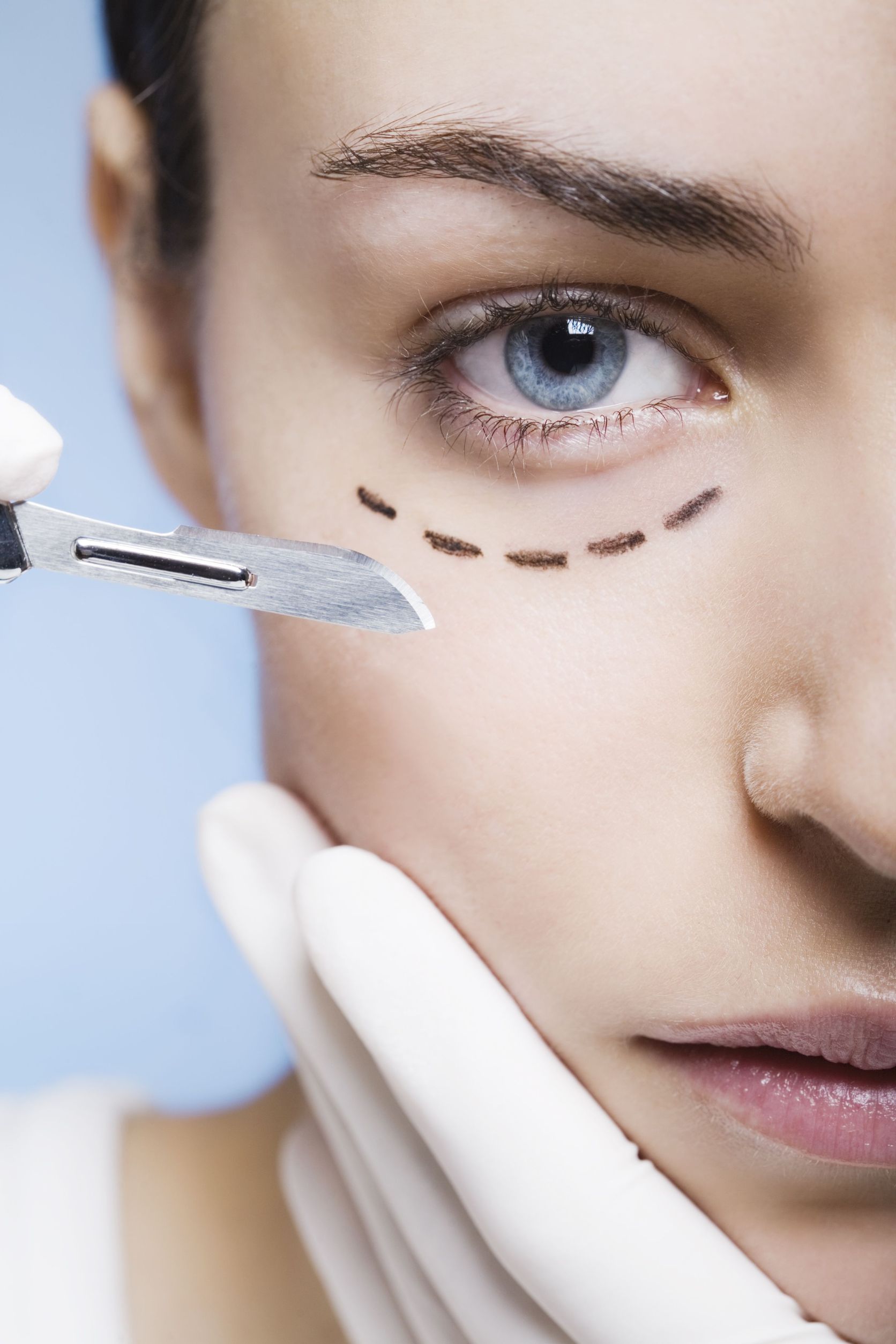 5 Cosmetic Surgeries with 1 Week or Less of Downtime