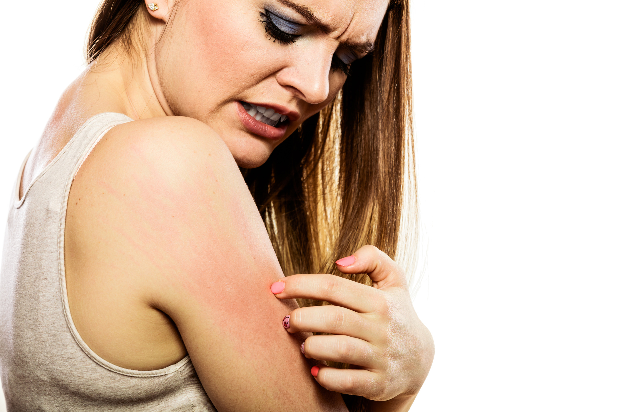 How Anyone in the US Can Relieve the Itching Caused by Shingles